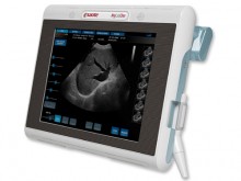 Esaote MyLab One Portable Ultrasound